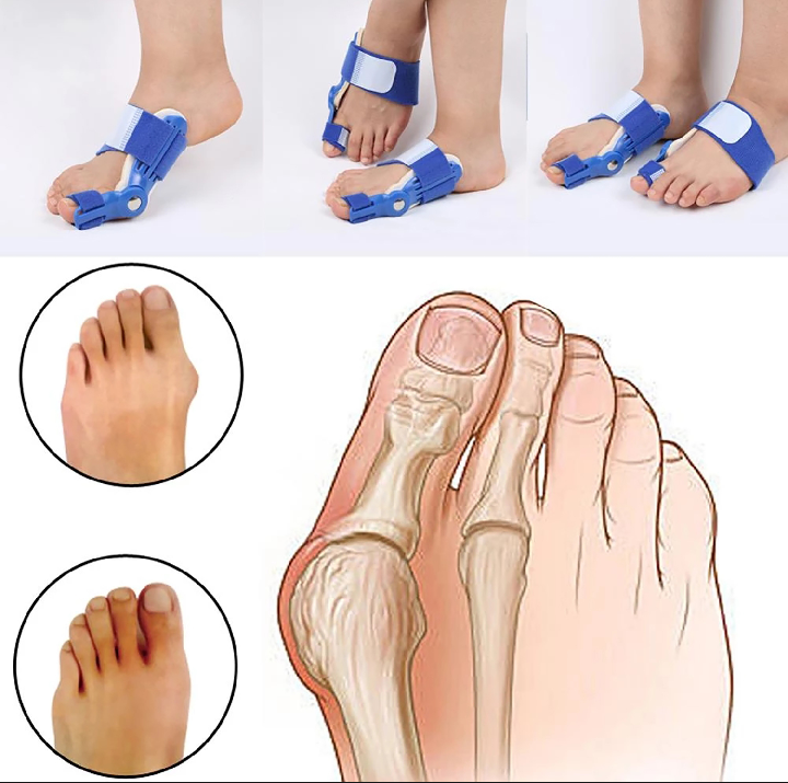 High Quality Orth Feet Thumb straight